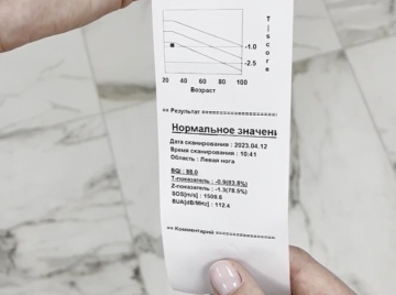 Денситометрия